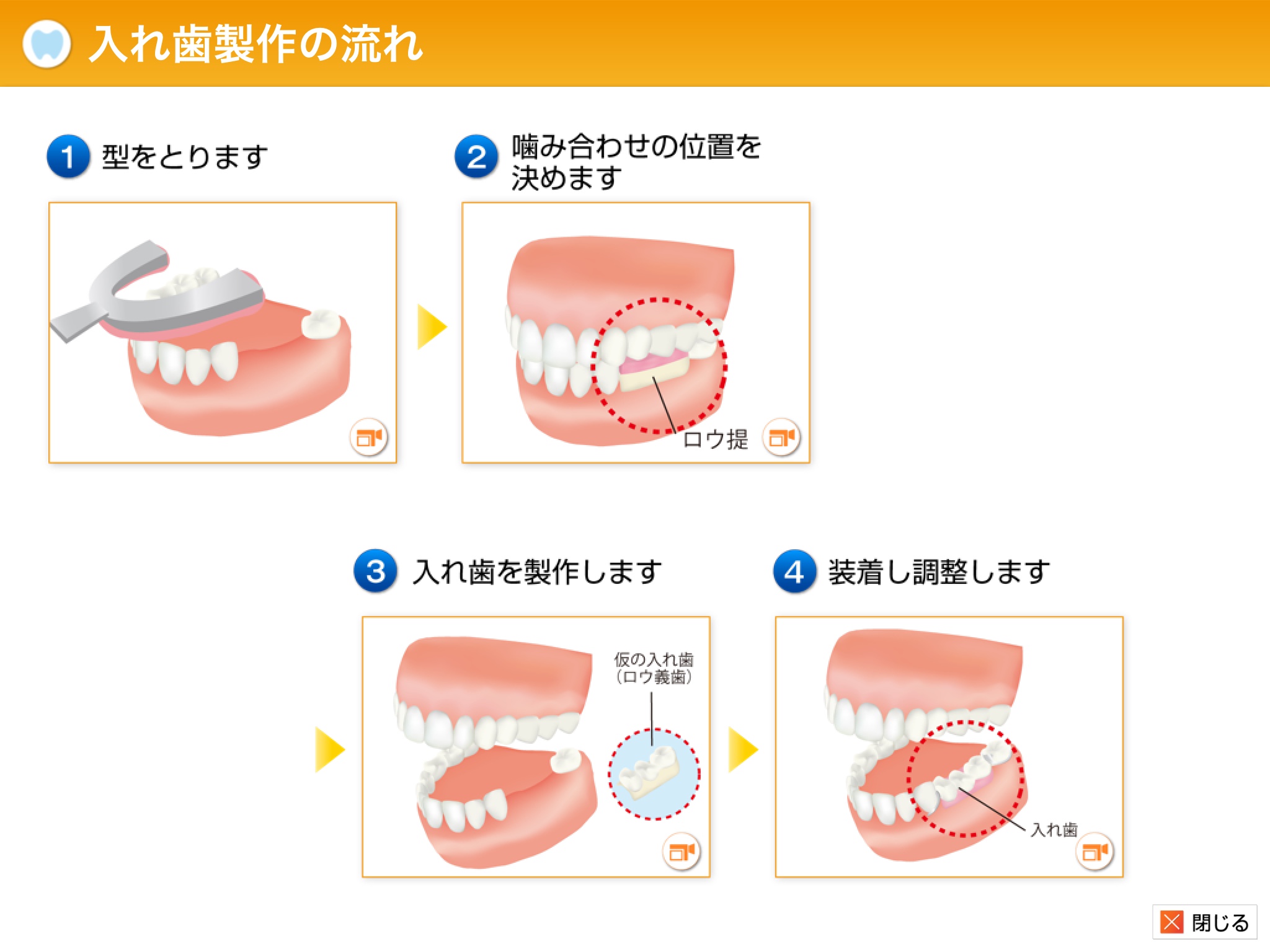 義歯 の 調整