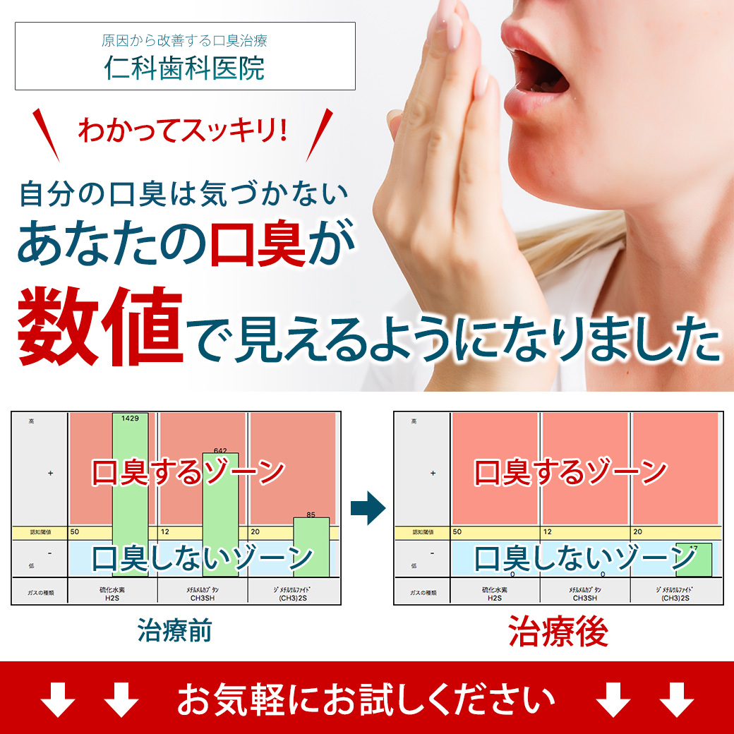 京都　口臭治療　歯医者