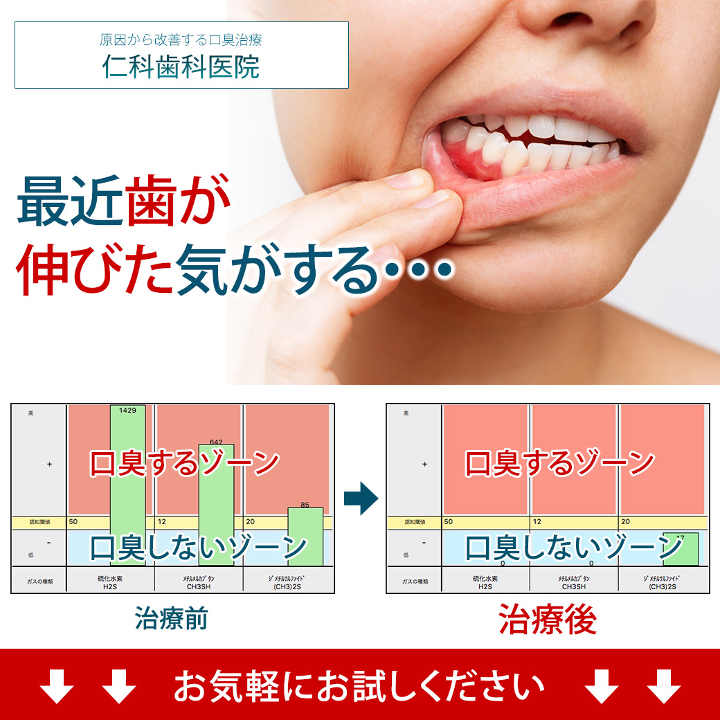 歯槽 膿 漏