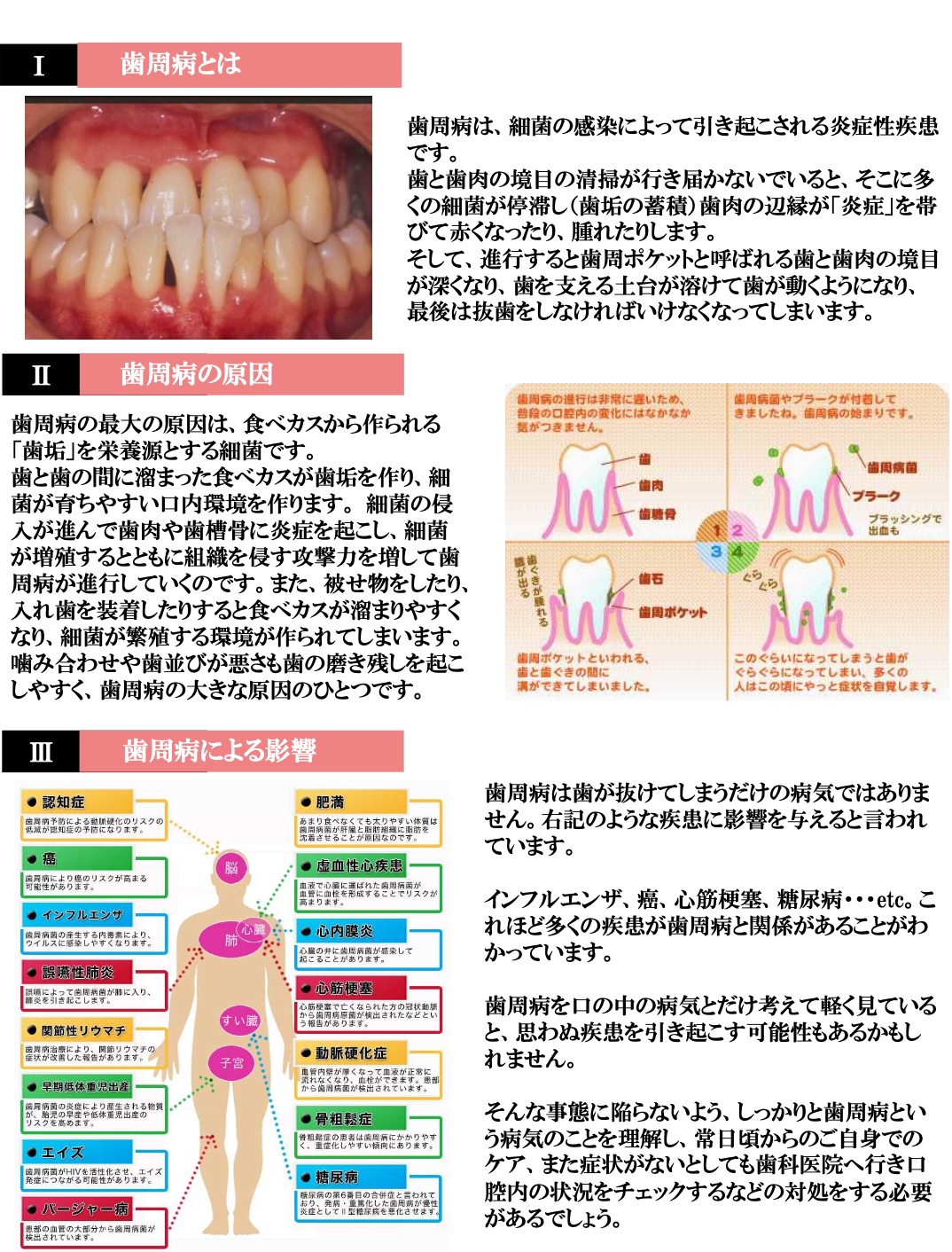 歯周ポケットとは？ - 仁科歯科医院
