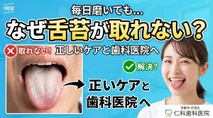 舌苔取れない状態の舌
