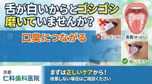 舌苔と舌の正しいケア